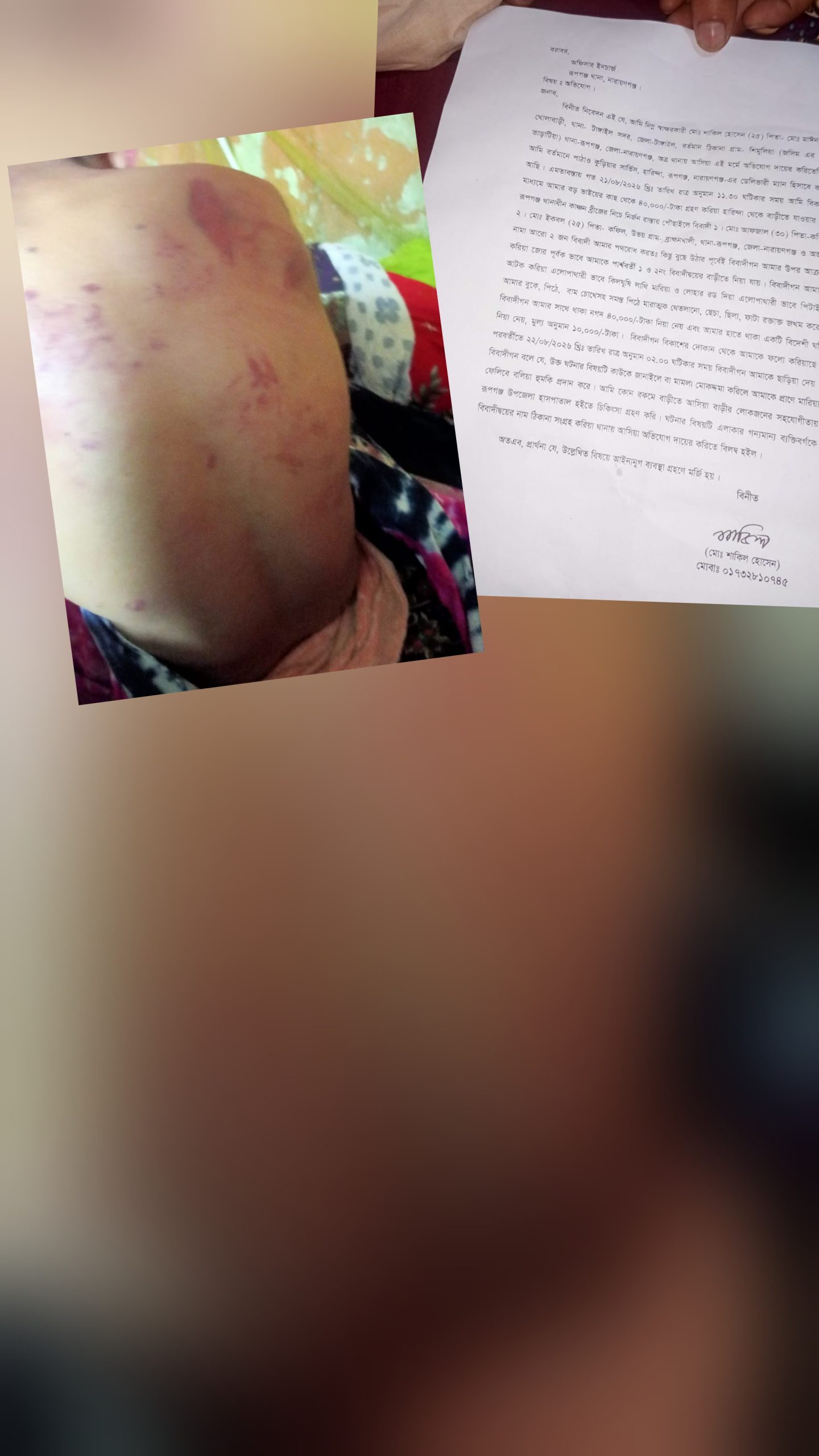 রূপগঞ্জে পাঠাও কর্মীকে আটকে রেখে মারধর, নগদ টাকা ও মালামাল ছিনতাই